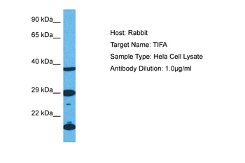 TIFA Rabbit Polyclonal Antibody
