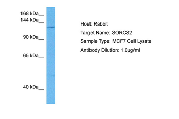 SORCS2 Rabbit Polyclonal Antibody