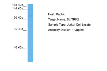 SLITRK2 Rabbit Polyclonal Antibody