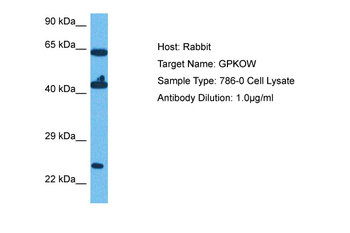 GPKOW Rabbit Polyclonal Antibody