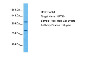 NAT10 Rabbit Polyclonal Antibody