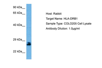 HLA-DRB1 Rabbit Polyclonal Antibody