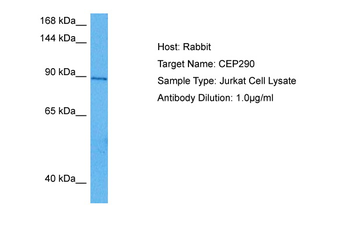 CEP290 Rabbit Polyclonal Antibody