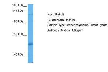 HIP1R Rabbit Polyclonal Antibody