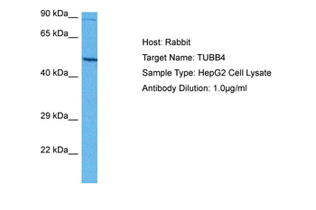TUBB4A Rabbit Polyclonal Antibody