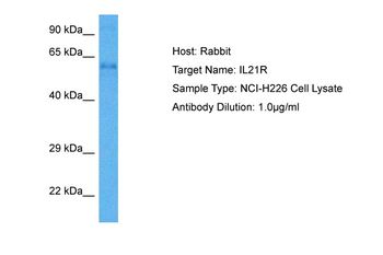 IL21R Rabbit Polyclonal Antibody