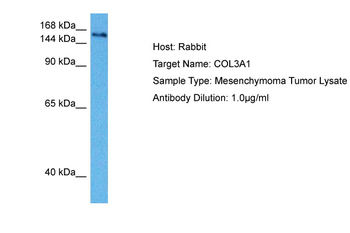 COL3A1 Rabbit Polyclonal Antibody