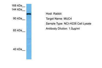 MUC4 Rabbit Polyclonal Antibody