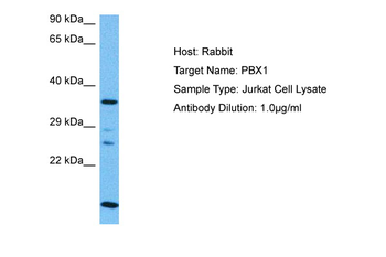 PBX1 Rabbit Polyclonal Antibody