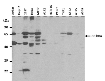 SLC1A3 Rabbit Polyclonal Antibody