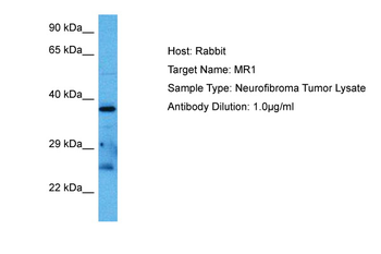 MR1 Rabbit Polyclonal Antibody