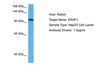ERAP1 Rabbit Polyclonal Antibody