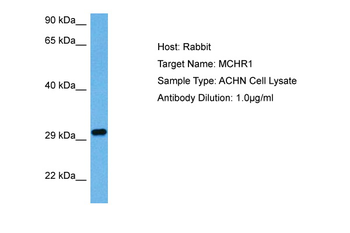MCHR1 Rabbit Polyclonal Antibody