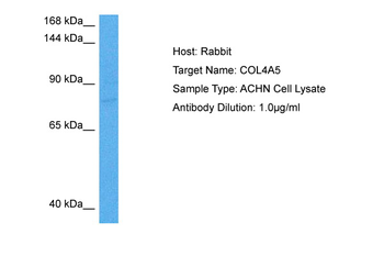COL4A5 Rabbit Polyclonal Antibody