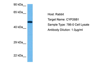 CYP26B1 Rabbit Polyclonal Antibody
