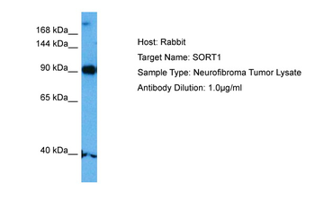 SORT1 Rabbit Polyclonal Antibody
