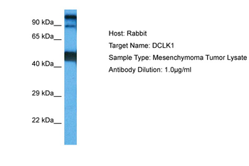 DCLK1 Rabbit Polyclonal Antibody