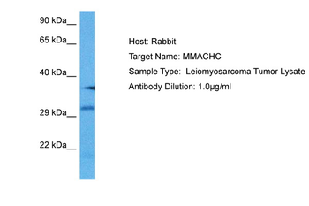 MMACHC Rabbit Polyclonal Antibody