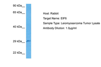 EIF6 Rabbit Polyclonal Antibody