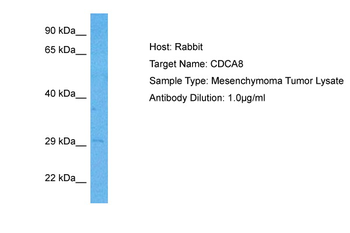 CDCA8 Rabbit Polyclonal Antibody