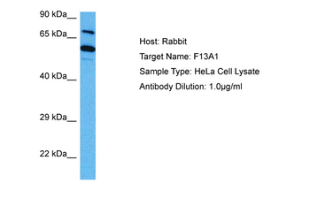 F13A1 Rabbit Polyclonal Antibody