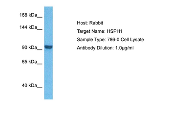 HSPH1 Rabbit Polyclonal Antibody