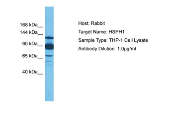 HSPH1 Rabbit Polyclonal Antibody