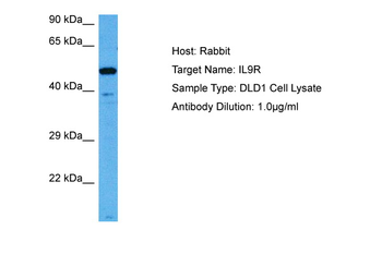 IL9R Rabbit Polyclonal Antibody