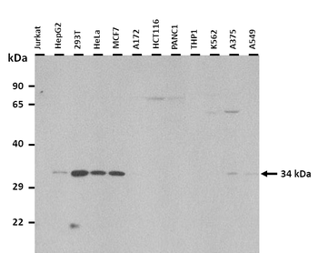 CDK4 Rabbit Polyclonal Antibody