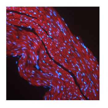 IGF1R Rabbit Polyclonal Antibody
