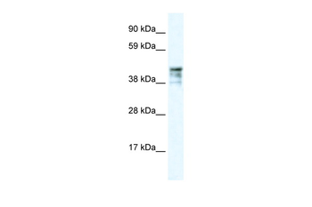 KRT15 Rabbit Polyclonal Antibody