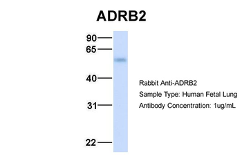 ADRB2 Rabbit Polyclonal Antibody