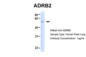 ADRB2 Rabbit Polyclonal Antibody