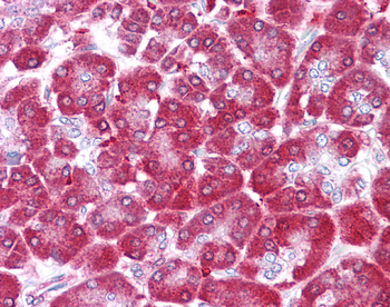 NME1 Rabbit Polyclonal Antibody