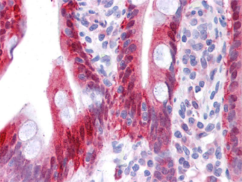 NME1 Rabbit Polyclonal Antibody