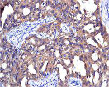 NME1 Rabbit Polyclonal Antibody
