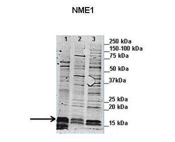 NME1 Rabbit Polyclonal Antibody