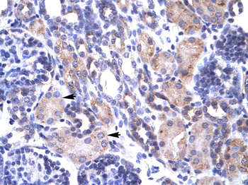 TRAP1 Rabbit Polyclonal Antibody