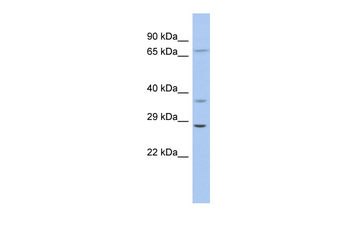 ASCL1 Rabbit Polyclonal Antibody