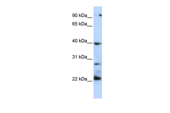 TNFRSF10B Rabbit Polyclonal Antibody