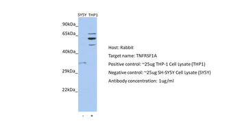 TNFRSF1A Rabbit Polyclonal Antibody