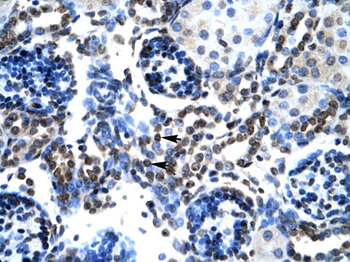 BAX Rabbit Polyclonal Antibody
