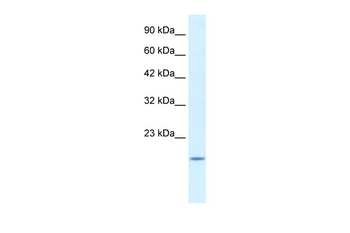 BAX Rabbit Polyclonal Antibody