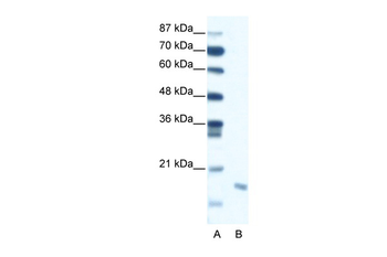 DIABLO Rabbit Polyclonal Antibody