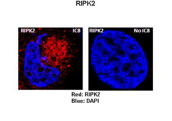 RIPK2 Rabbit Polyclonal Antibody