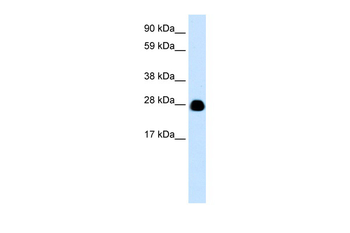 YWHAH Rabbit Polyclonal Antibody
