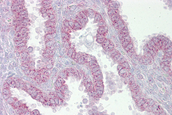 CDK9 Rabbit Polyclonal Antibody