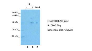 CDK7 Rabbit Polyclonal Antibody