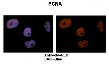 PCNA Rabbit Polyclonal Antibody
