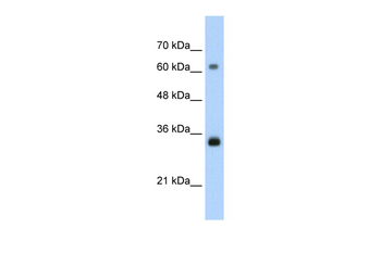 PCNA Rabbit Polyclonal Antibody